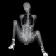 Illustration for article titled X-ray pinups: Boners for bones